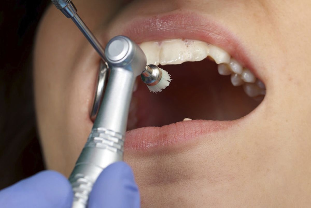 LIBERTY Dental untuk melayani pasien Medicaid Clark, Washoe county